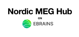 MEG Nord